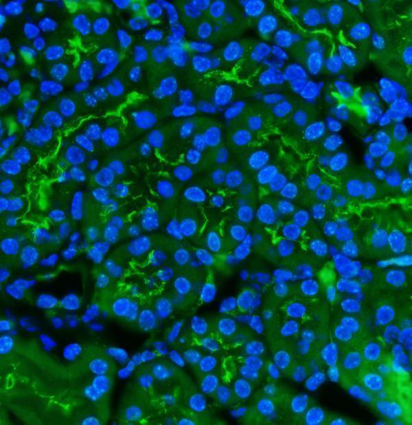 a02591 3 cd13 primary antibodies if testing 7