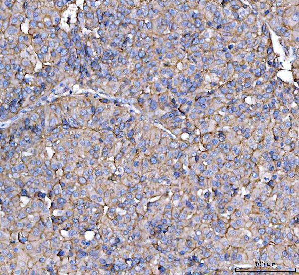 a02591 3 cd13 primary antibodies ihc testing 2