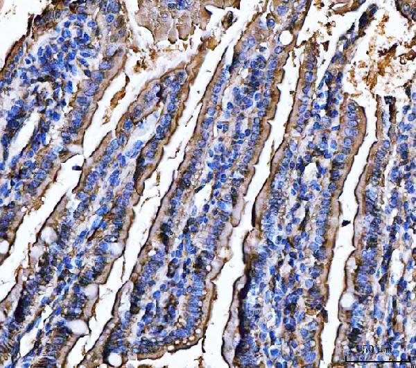 a02591 3 cd13 primary antibodies ihc testing 3
