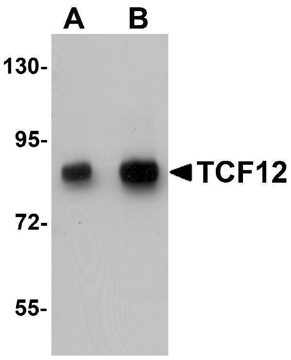 a02592 tcf12 primary antibodies wb testing 1