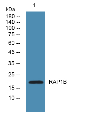 Western blot analysis of lysates from A431 cells, primary antibody was diluted at 1:1000, 4°over night