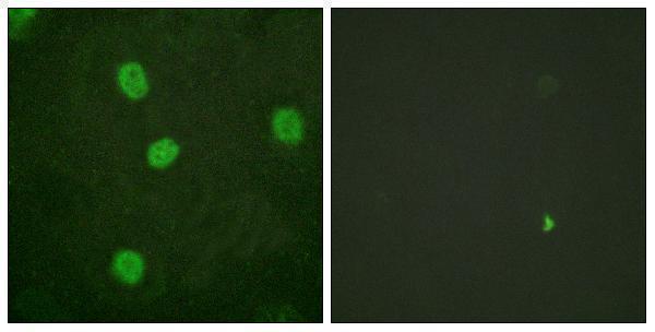 a02597s577 mybl2 primary antibodies if testing 3