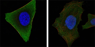 a02598 1 jak3 primary antibodyes if testing 1