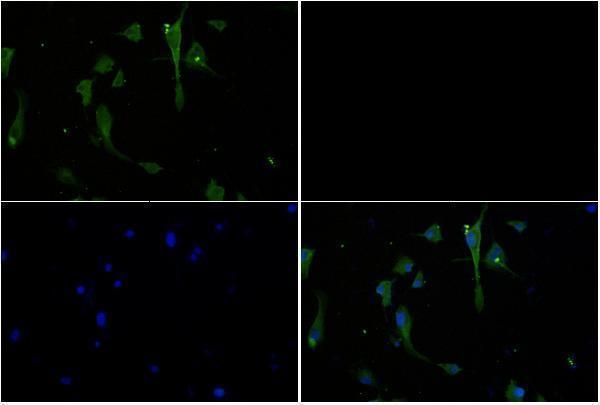 Immunofluorescence analysis of U-87MG cells using JAK3 (I781) antibody at dilution of 1:50