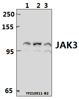 Western blot (WB) analysis of JAK3 (I781) polyclonal antibody at 1:2000 dilution
Lane1:SHSY5Y whole cell lysate(40ug)
Lane2:SP2/0 whole cell lysate(40ug)
Lane3:C6 whole cell lysate(40ug)