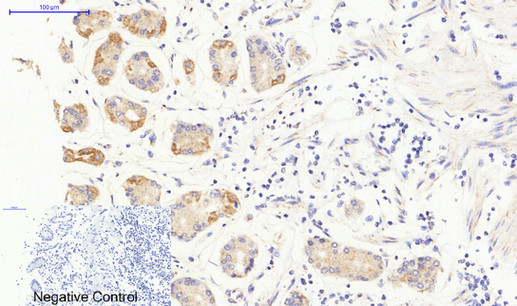 a02598 jak3 primary antibodies ihc testing 4