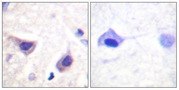 a02598 jak3 primary antibodies ihc testing 5
