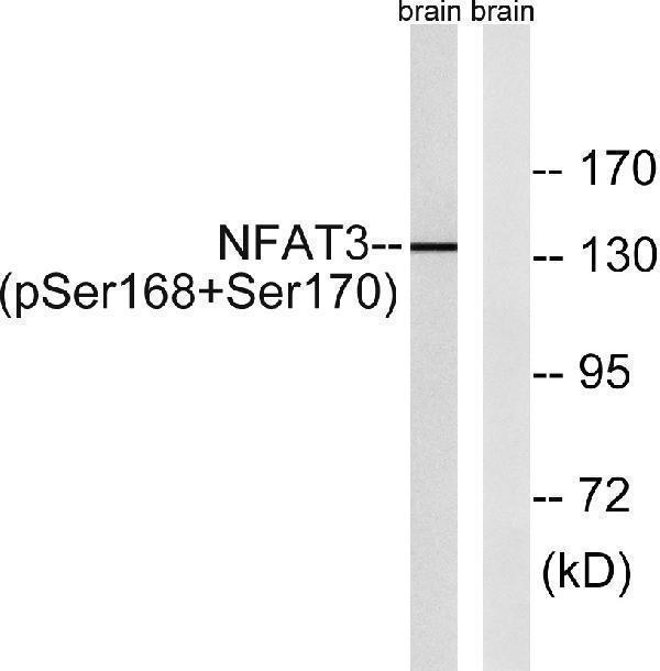 Western blot analysis of NFAT3 (Phospho-Ser168+Ser170) Antibody