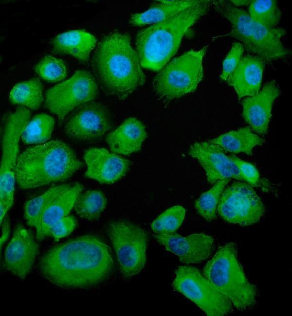 a02602 3 snd1 primary antibodies if testing 4