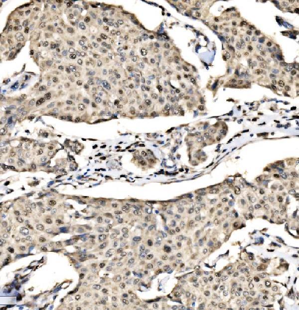  IHC analysis of SND1 using anti-SND1 antibody (A02602-3)
