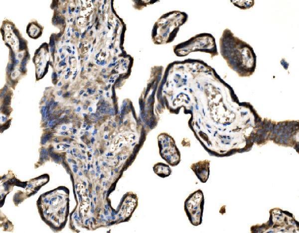  IHC analysis of SND1 using anti-SND1 antibody (A02602-3)