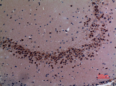 Immunohistochemical analysis of paraffin-embedded mouse-brain, antibody was diluted at 1:100