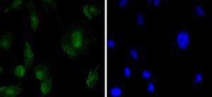 a02603 1 sox11 primary antiboties icc testing 1