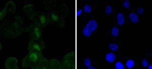 a02603 1 sox11 primary antiboties icc testing 2