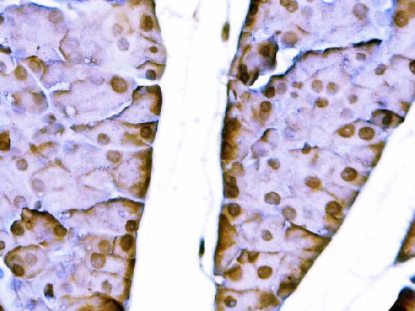  IHC analysis of Sox11 using anti-Sox11 antibody (A02603-3)
