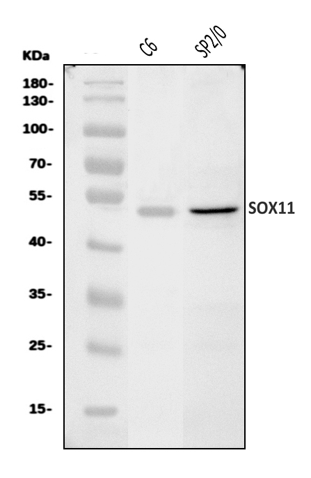  Western blot analysis of Sox11 using anti-Sox11 antibody (A02603-3)