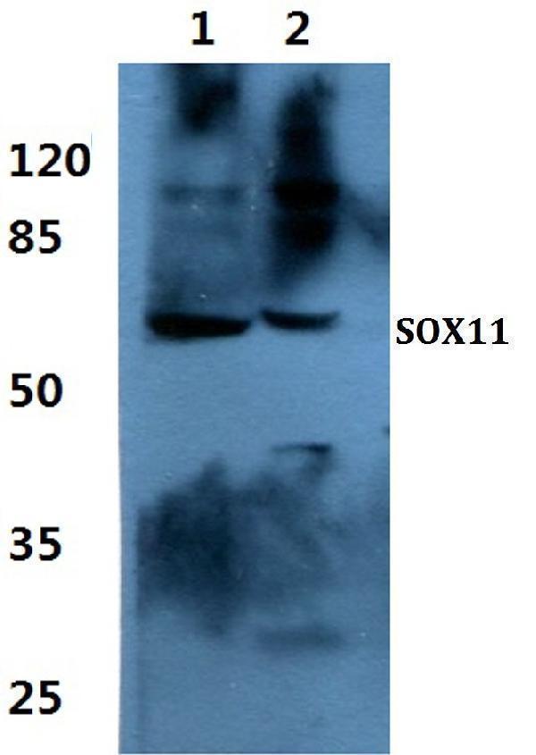 a02603 sox11 primary antiboties wb testing 1
