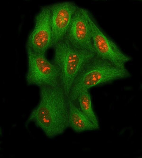 a02606 1 ssrp1 primary antibodies if testing 7