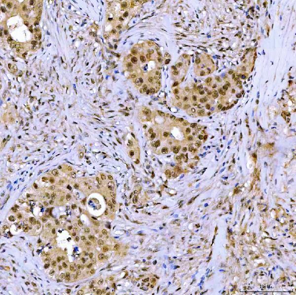  IHC analysis of SSRP1 using anti-SSRP1 antibody (A02606-1)