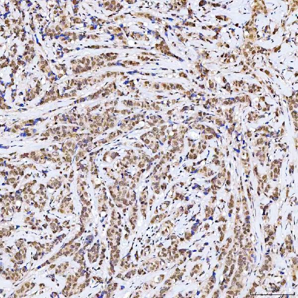  IHC analysis of SSRP1 using anti-SSRP1 antibody (A02606-1)