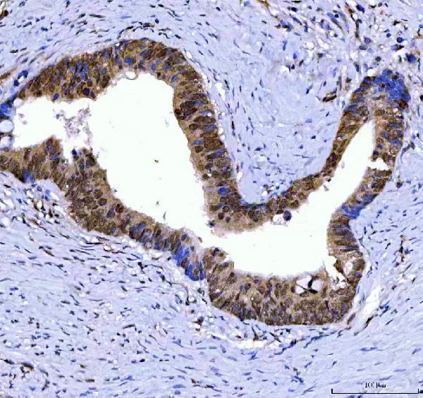 a02606 1 ssrp1 primary antibodies ihc testing 4