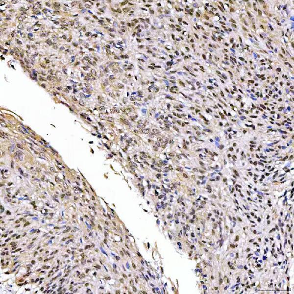 a02606 1 ssrp1 primary antibodies ihc testing 5