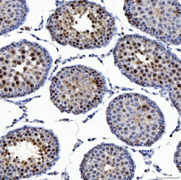 a02606 1 ssrp1 primary antibodies ihc testing 6