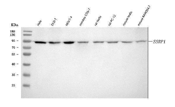  Western blot analysis of SSRP1 using anti-SSRP1 antibody (A02606-1)