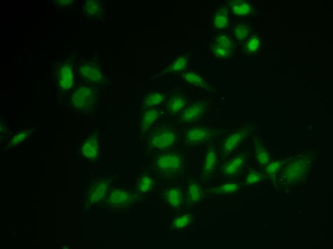 Immunofluorescence analysis of U2OS cells using SSRP1 antibody 