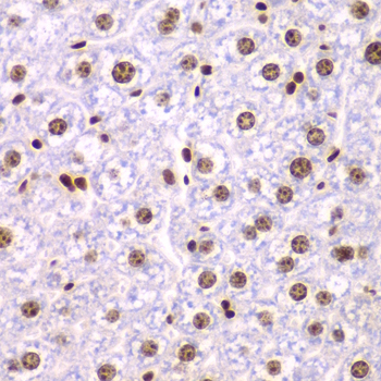 Immunohistochemistry of paraffin-embedded mouse liver using SSRP1 antibody  at dilution of 1:200 