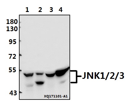 Western blot (WB) analysis of JNK1/2/3 (T178) pAb at 1:500 dilution
Lane1:K562 whole cell lysate(40ug)
Lane2:MCF-7 whole cell lysate(40ug)
Lane3:The Brain tissue lysate of Rat(40ug)
Lane4:The Brain tissue lysate of Mouse(40ug)