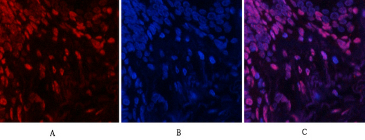 a02608y185 1 mapk8 primary antibodies if testing 12