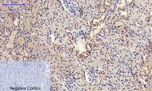 a02608y185 1 mapk8 primary antibodies ihc testing 10