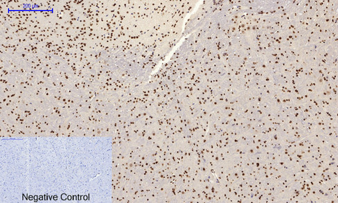 a02608y185 1 mapk8 primary antibodies ihc testing 11