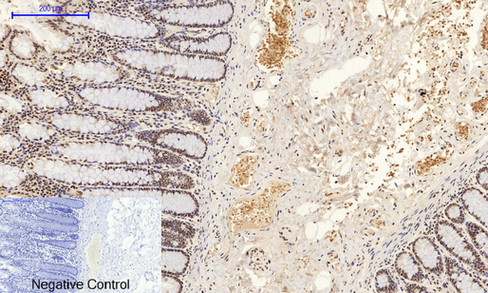 a02608y185 1 mapk8 primary antibodies ihc testing 5
