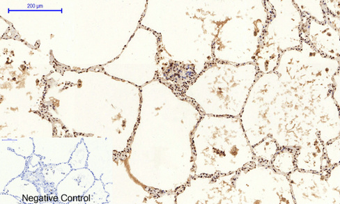 a02608y185 1 mapk8 primary antibodies ihc testing 6
