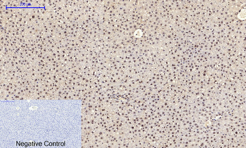 a02608y185 1 mapk8 primary antibodies ihc testing 8