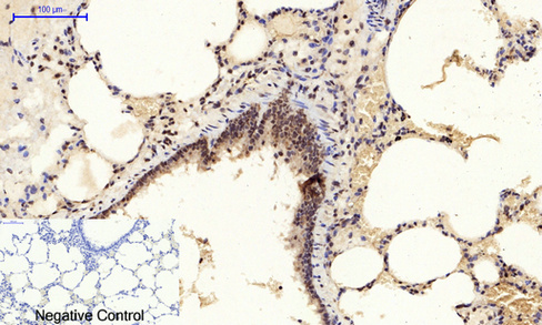 a02608y185 1 mapk8 primary antibodies ihc testing 9