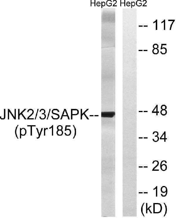 Western blot analysis of lysates from HepG2 cells treated with nocodazole 1ug/ml 16h, using SAPK/JNK (Phospho-Tyr185) Antibody