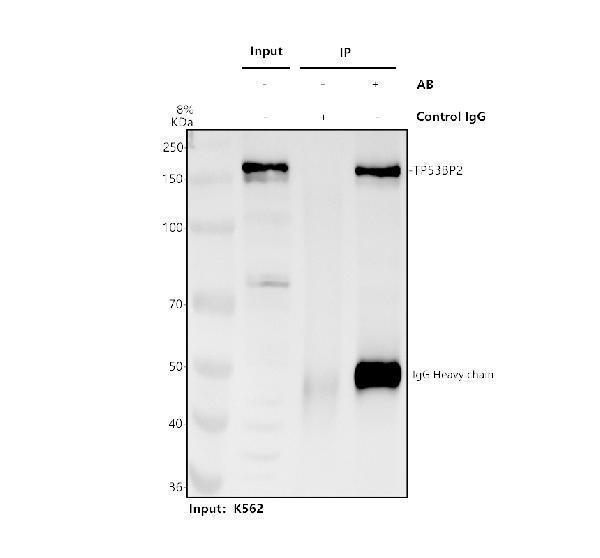 Immunoprecipitating 53BP2/TP53BP2 in K562 whole cell lysate