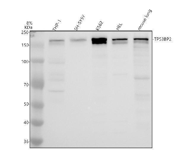 Western blot analysis of 53BP2/TP53BP2 using anti-53BP2/TP53BP2 antibody (A02609-3)