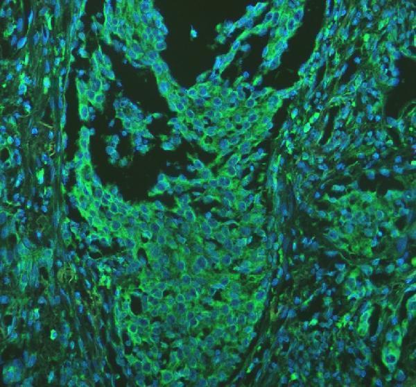 a02612 1 hal primary antibodies if testing 1