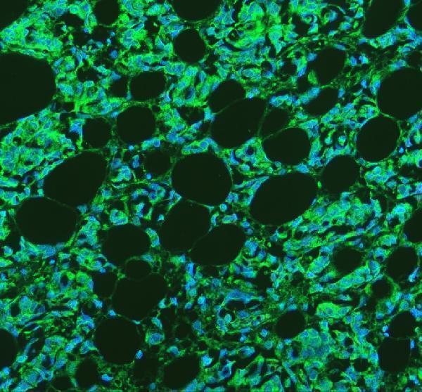 a02612 1 hal primary antibodies if testing 2