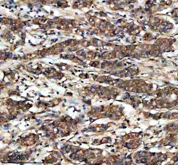 IHC analysis of HAL using anti-HAL antibody (A02612-1)