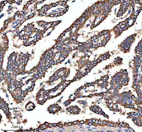 IHC analysis of HAL using anti-HAL antibody (A02612-1)