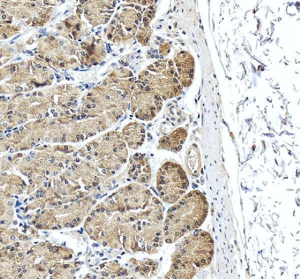 IHC analysis of PDCD5 using anti-PDCD5 antibody (A02613-1)