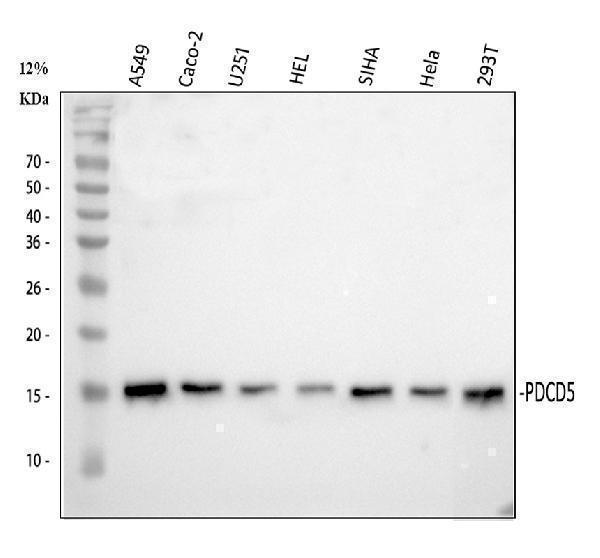  Western blot analysis of PDCD5 using anti-PDCD5 antibody (A02613-1)