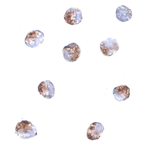 Immunocytochemistry of PDCD5 in Jurkat cells with PDCD5 antibody at 2 μg/mL