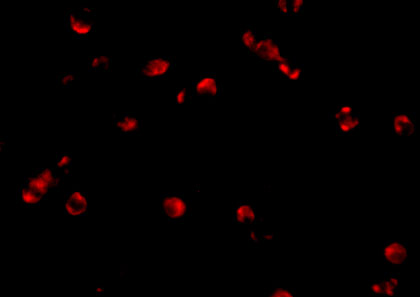 Immunofluorescence of PDCD5 in Jurkat cells with PDCD5 antibody at 10 μg/mL