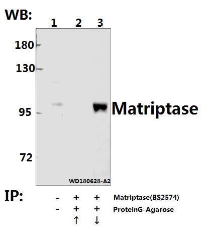 Immunoprecipitation of HEK293T cell lysate using Matriptase (K21) pAb (Sepharose Bead Conjugate) #BD0048(lane 2 and lane 3) 